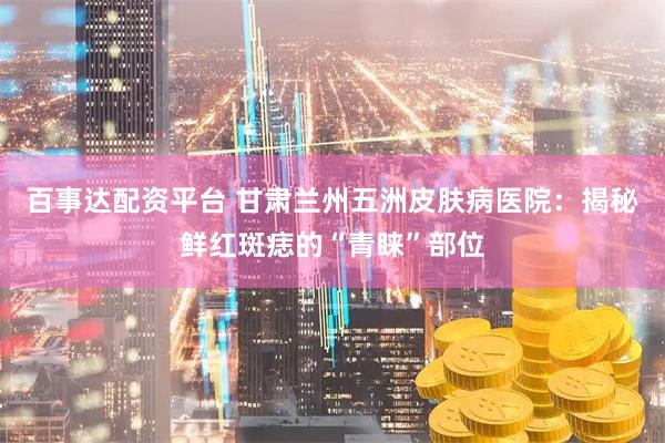 百事达配资平台 甘肃兰州五洲皮肤病医院：揭秘鲜红斑痣的“青睐”部位